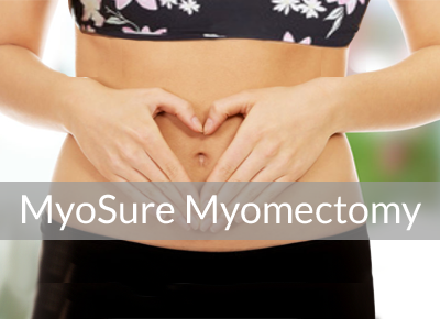 Perrysburg OB GYN Myomectomy